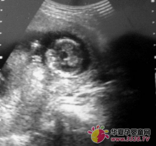 ����3����̥��b��ͼ