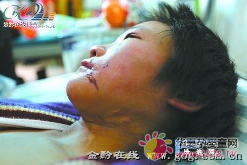 12��Ů����ĸ���ѹ����պ��ǯ�� �˺۴�Ŀ����