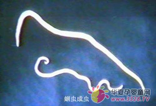 �����������л׳������Щ֢״