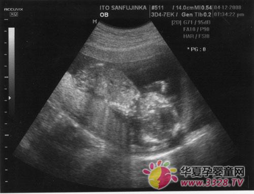 B��������