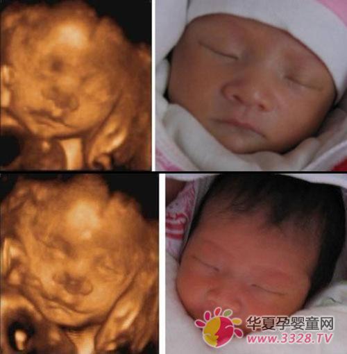 �����ڲʳ���ʲô����