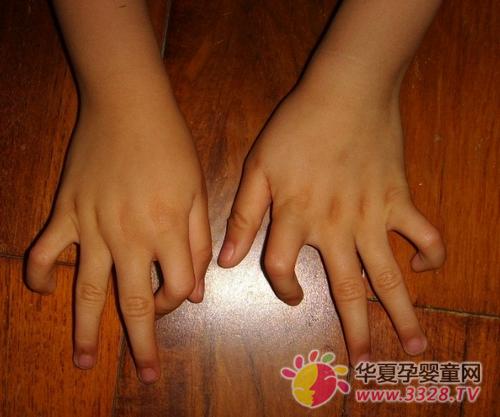 С��������ָ����Ҫ����������?