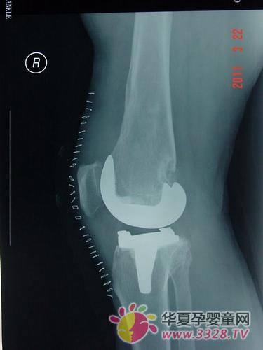 ���ȡ����䡱��5���Ȳ�����