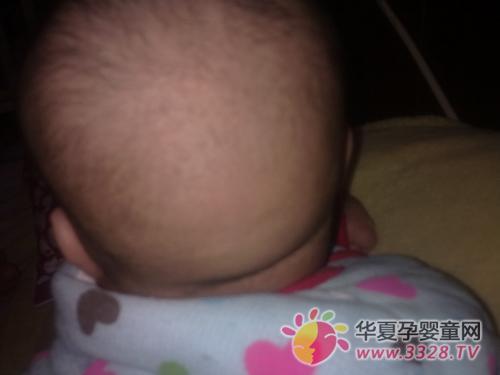 ��������ͷ����ô�죿