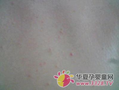 ���챦����������ʲô�ã�