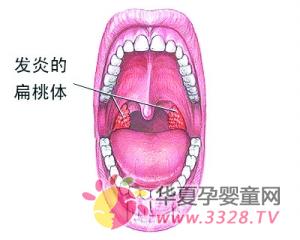 �Ҽұ��������巴�����ף�������ô�����أ�ƽʱ�����Ԥ����