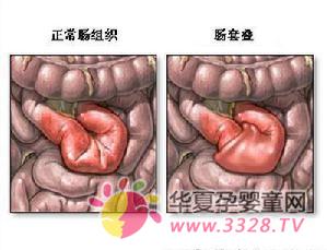 ����Ϊʲô�ᷢ�����׵���