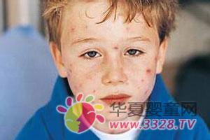 ������ˮ��Ҫע����ʳ